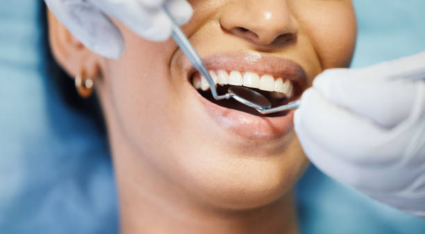 Best Emergency Wisdom Teeth Removal in Northlake, IL